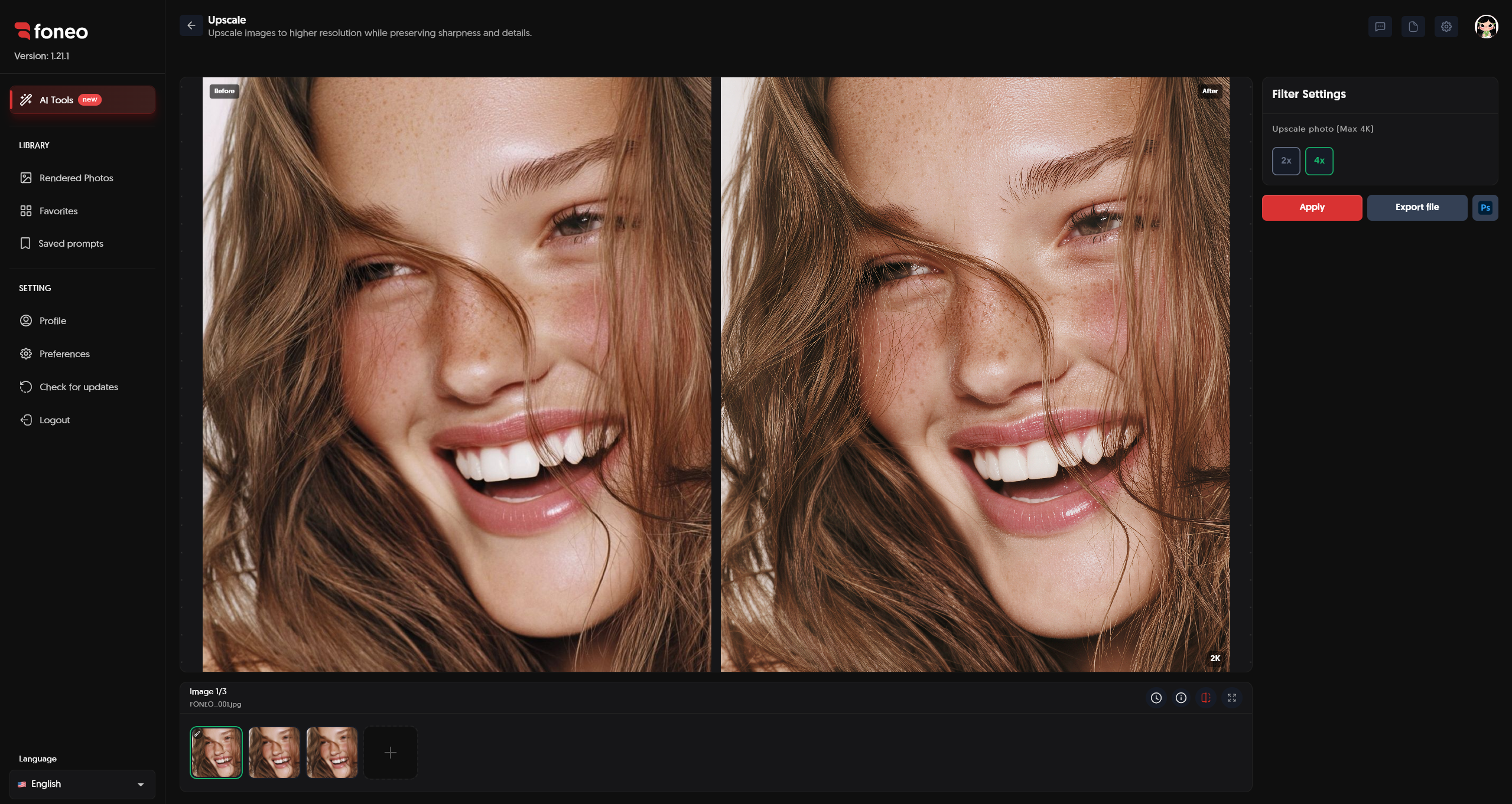 Before and after comparison after upscaling on Foneo